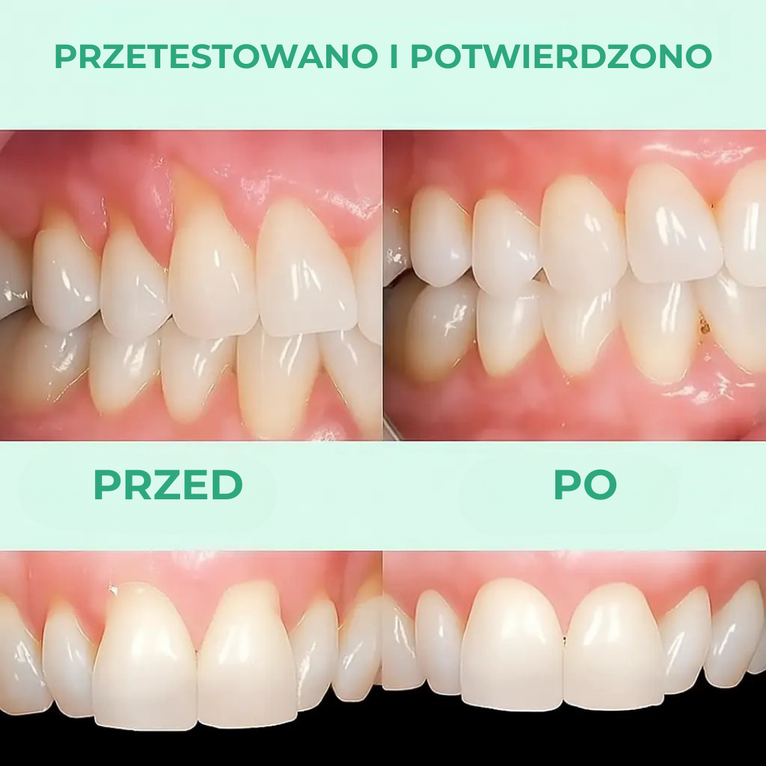 GumCare™ | Zdrowsze dziąsła, świeższy oddech – widoczne rezultaty już w kilka tygodni!