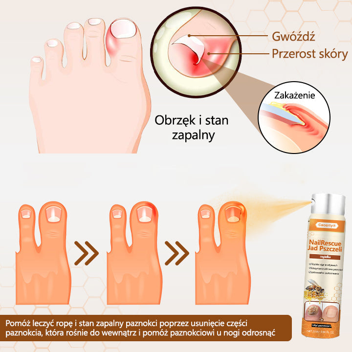 ✅【Oficjalny sklep flagowy】Timilk® spray z jadem pszczelim nailrescue