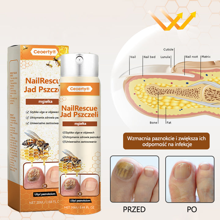 ✅【Oficjalny sklep flagowy】Timilk® spray z jadem pszczelim nailrescue