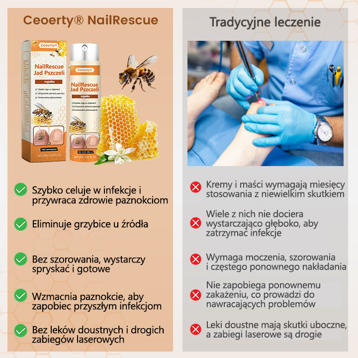 ✅【Oficjalny sklep flagowy】Timilk® spray z jadem pszczelim nailrescue