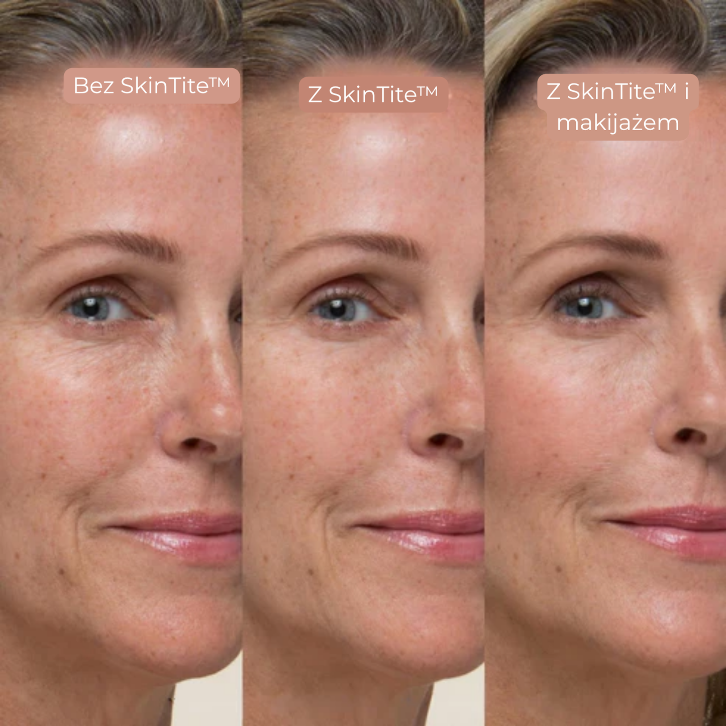 SkinTite™ | Natychmiastowy efekt przeciw opuchliźnie i zmarszczkom (89)