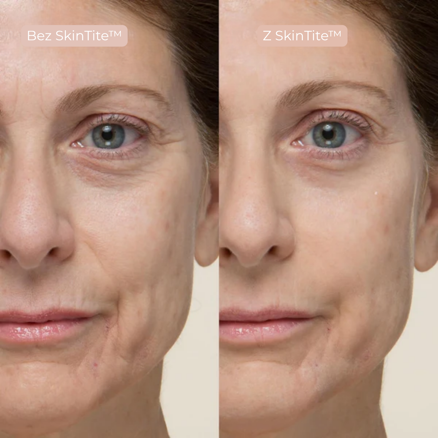 SkinTite™ | Natychmiastowy efekt przeciw opuchliźnie i zmarszczkom