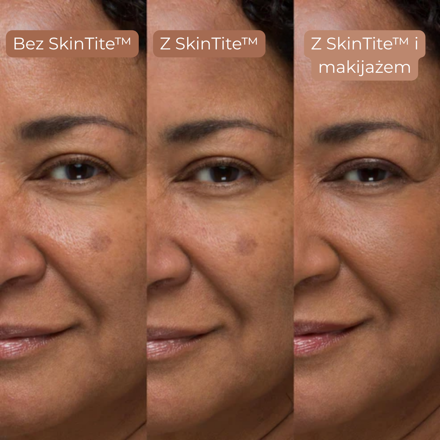 SkinTite™ | Natychmiastowy efekt przeciw opuchliźnie i zmarszczkom (89)