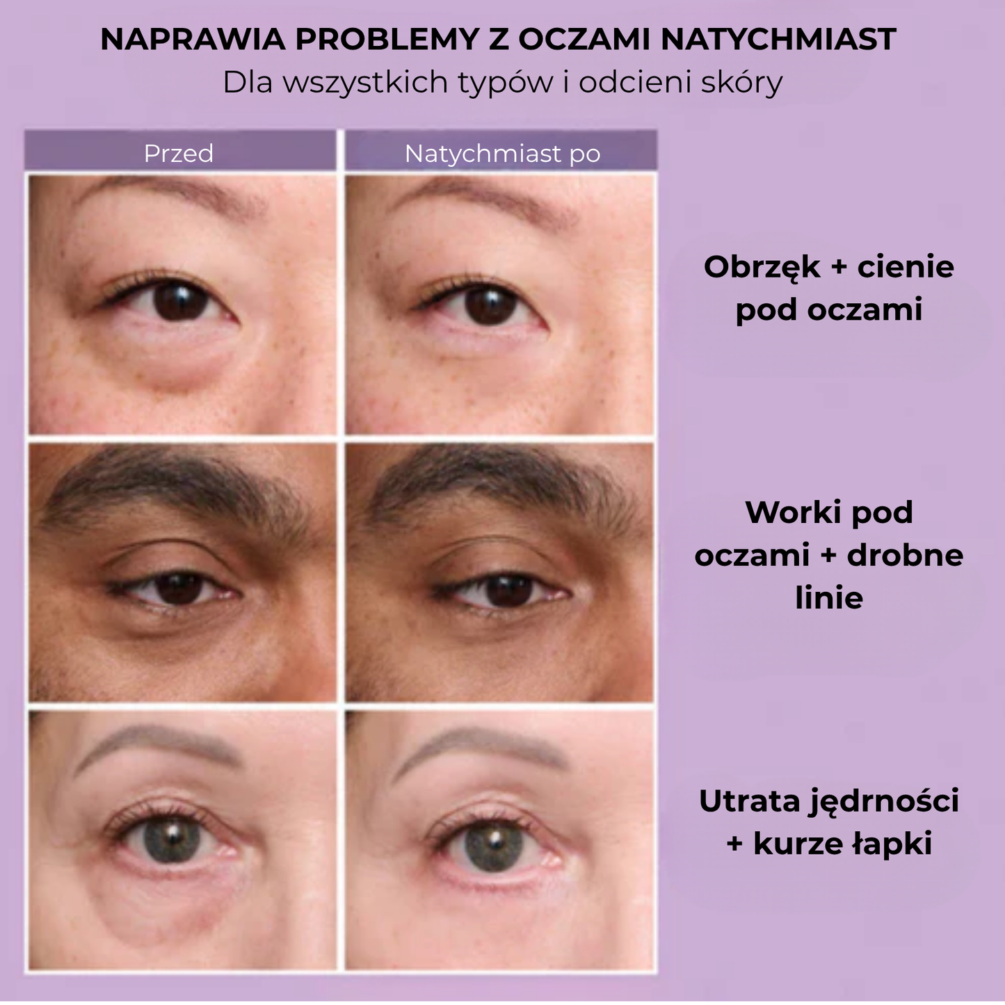 SkinTite™ | Natychmiastowy efekt przeciw opuchliźnie i zmarszczkom (89)